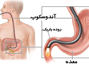 مدفوع خونی؛ علل و درمان مدفوع خونی؛ علل و درمان